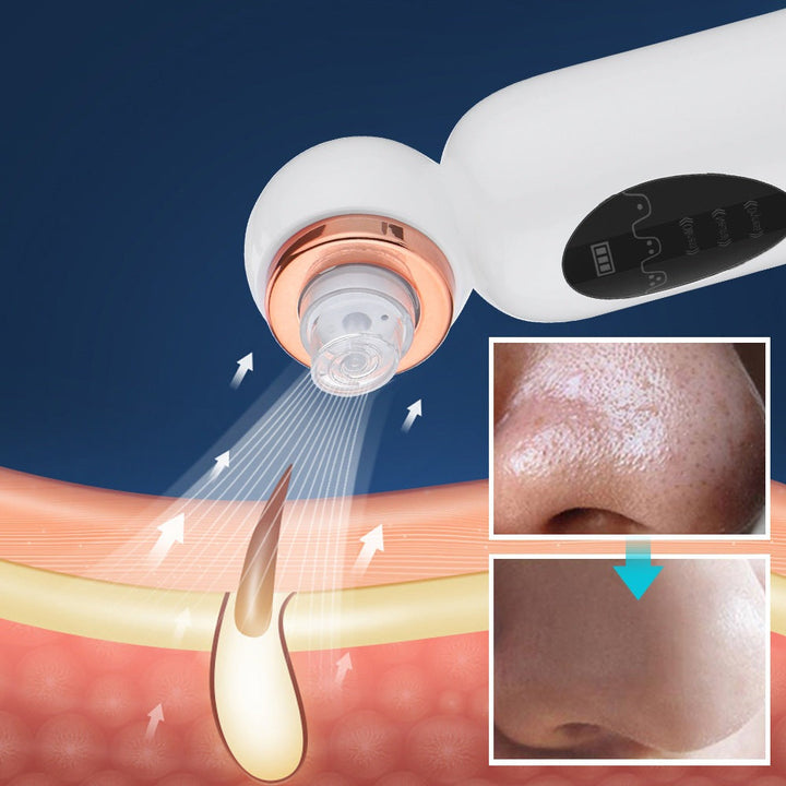Mee-eter Remover and Hydrodermabrasion - HydraGlow