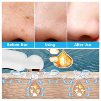Mee-eter Remover and Hydrodermabrasion - HydraGlow