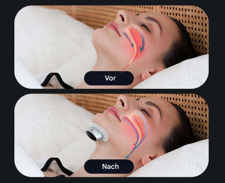 Dispositivo para apnea del sueño - AirEase