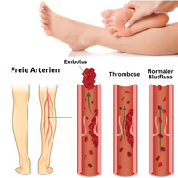 Foot Massage Mat – AcupressureFlow