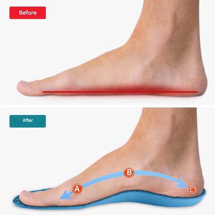 Orthopedic Insoles – StepRelief