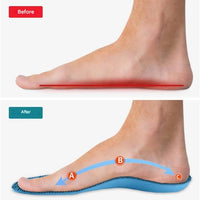 Orthopedic Insoles – StepRelief