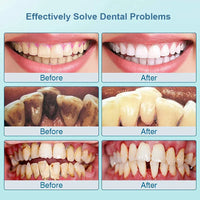 Ultrasone Tooth Cleaner - SonicClean