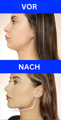 Jaw Trainer – JawSculptor Pro