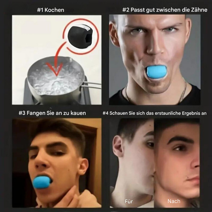 Jaw Trainer – JawSculptor Pro