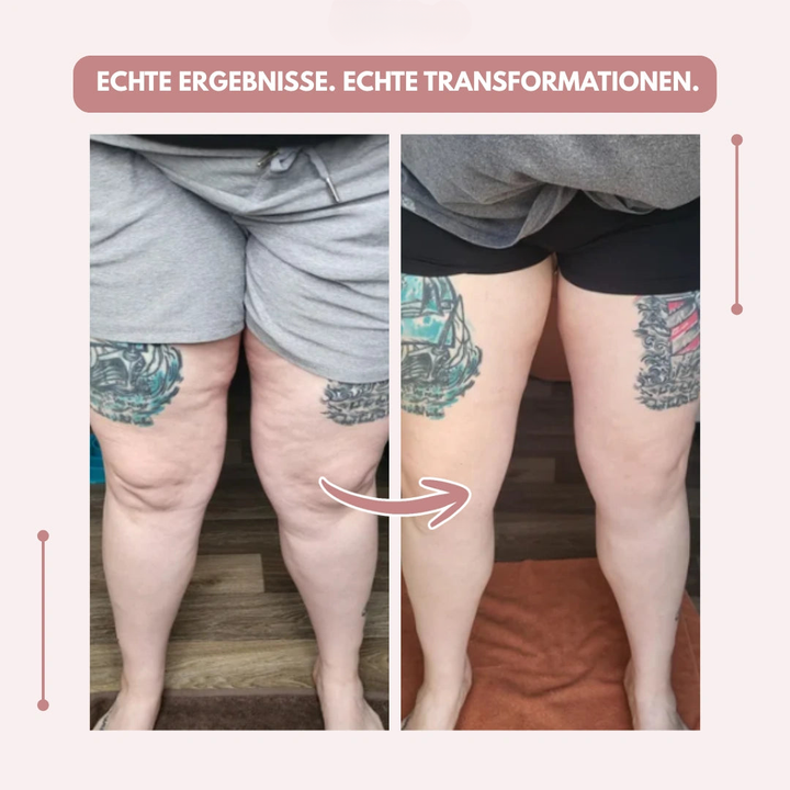 Vorher-nachher-Vergleich der Beine einer tätowierten Person von vorn, links in grauer Shorts, rechts in schwarzer Shorts mit glatterer Kontur. 18