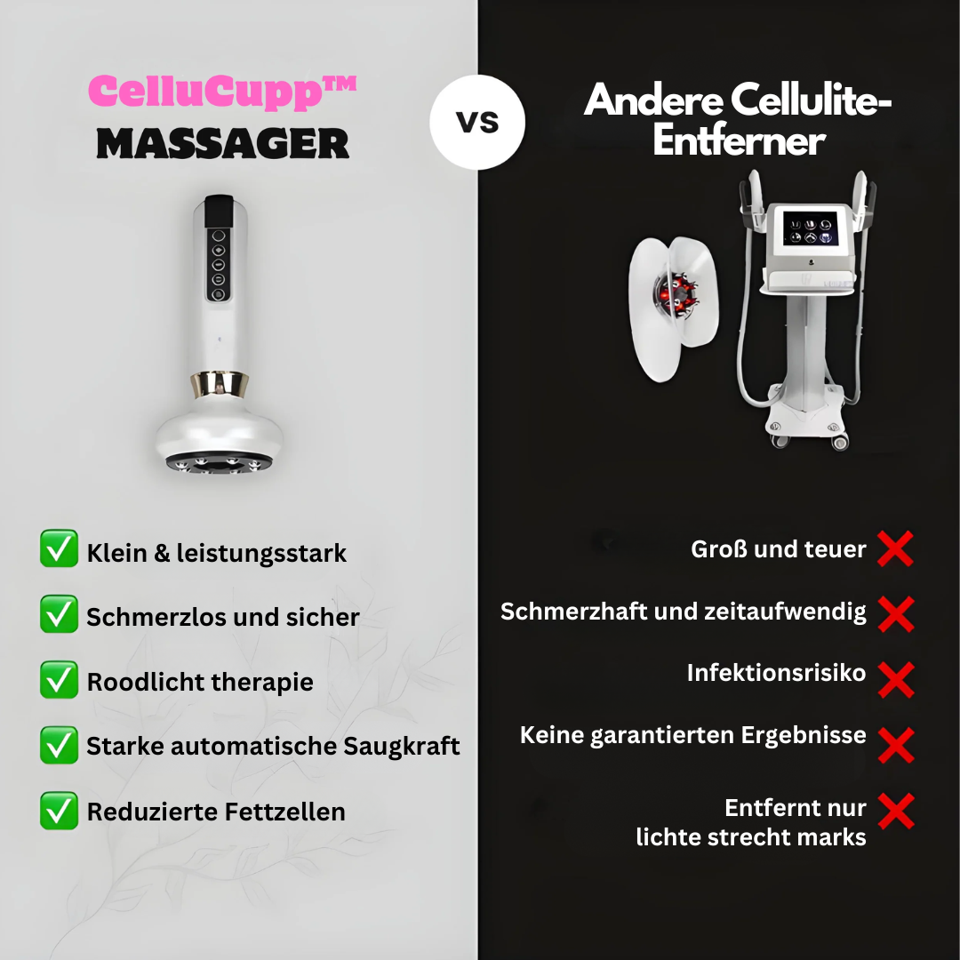 Anti-Cellulite Cupping Device – SlimCupp