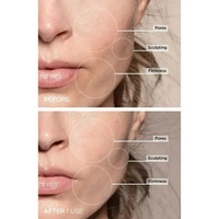7-in-1 LED Facial Firming & Massage Tool – Vénera