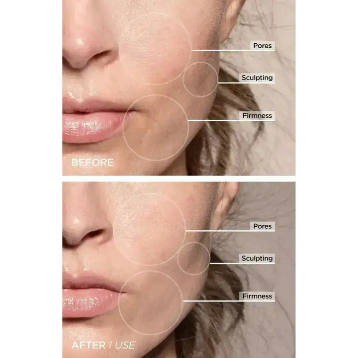 7-in-1 LED Facial Firming & Massage Tool – Vénera