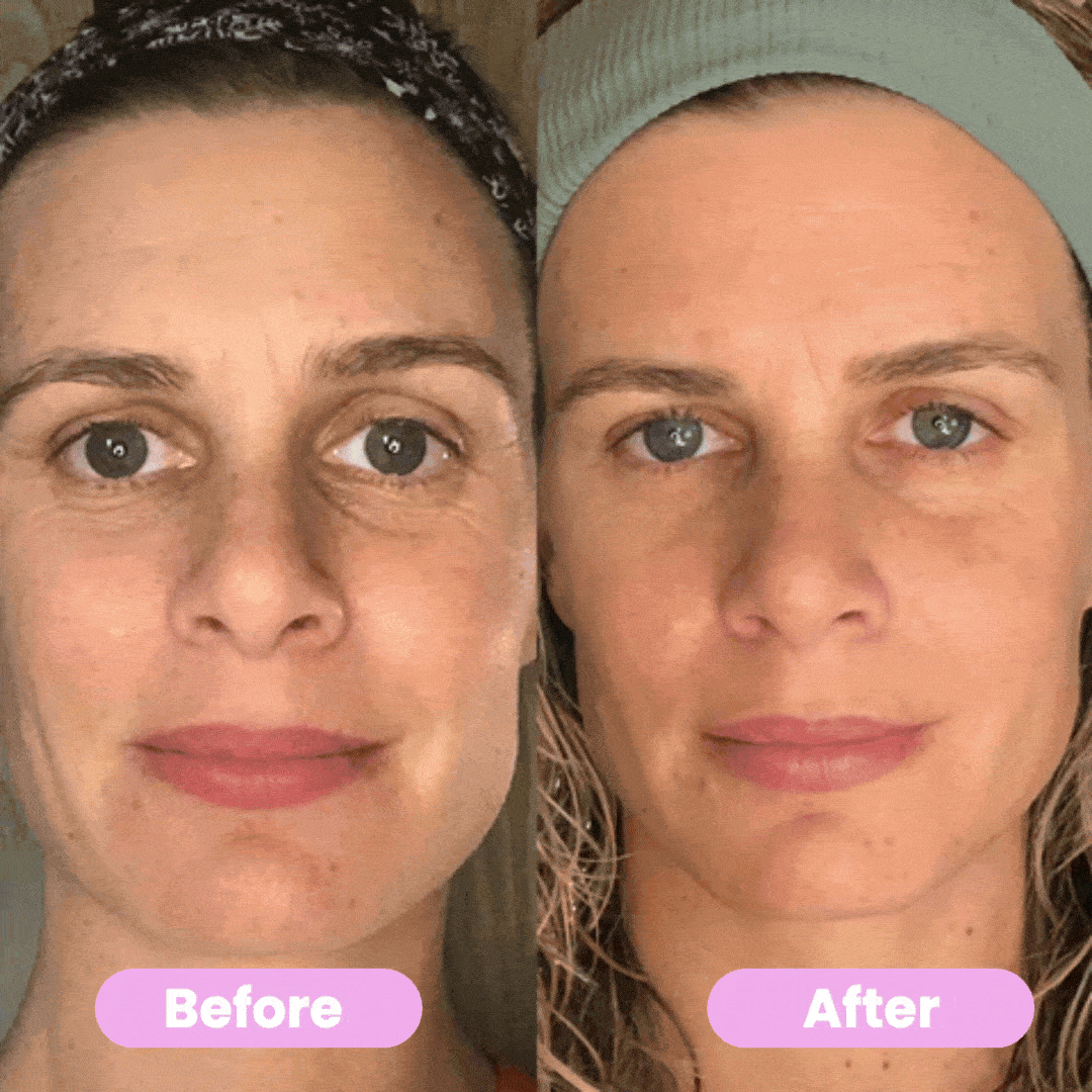 7-in-1 LED Facial Firming & Massage Tool – Vénera
