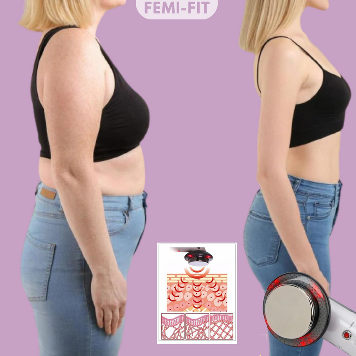 3-i-1 fedt- og cellulitefjerner – SlimShape