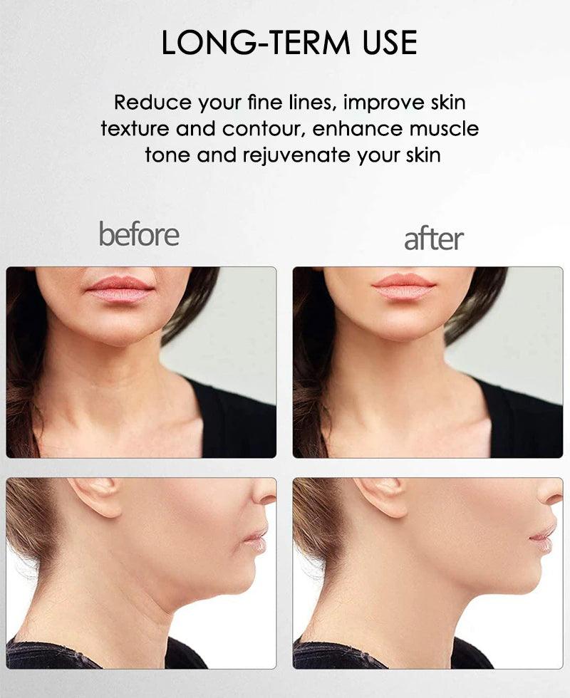 Masajeador facial de microcorriente – FirmGlow